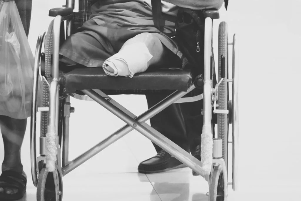 A black and white photo of a man who has had both legs amputated. He is sitting in a wheelchair and one limb is partially wrapped in gauze. 